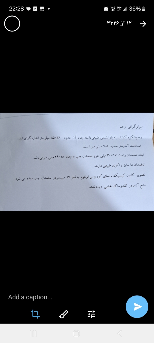 تفسیر سونو وجود کیست تفسیر سونو وجود کیست