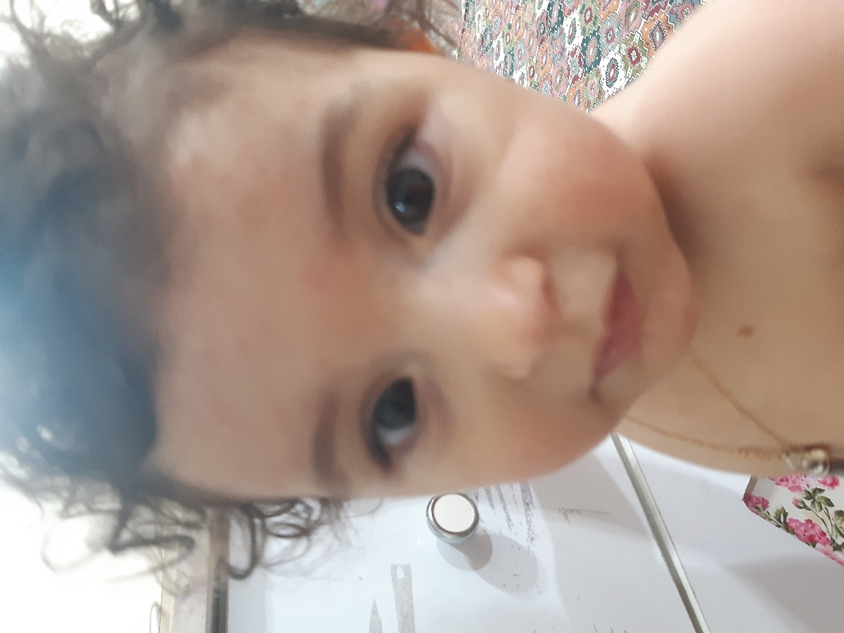 دخترم یک سالشه و ۶ روزه که تب شدید داره دخترم یک سالشه و ۶ روزه که تب شدید داره