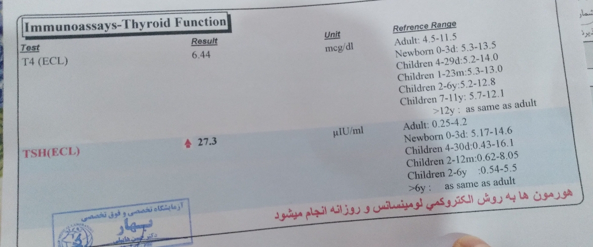 تفسیر ازمایش تیروئید نوزاد