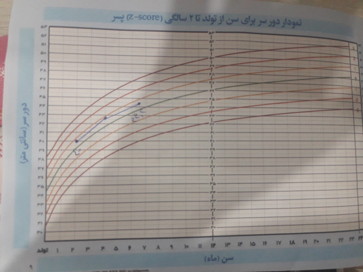 دور سر