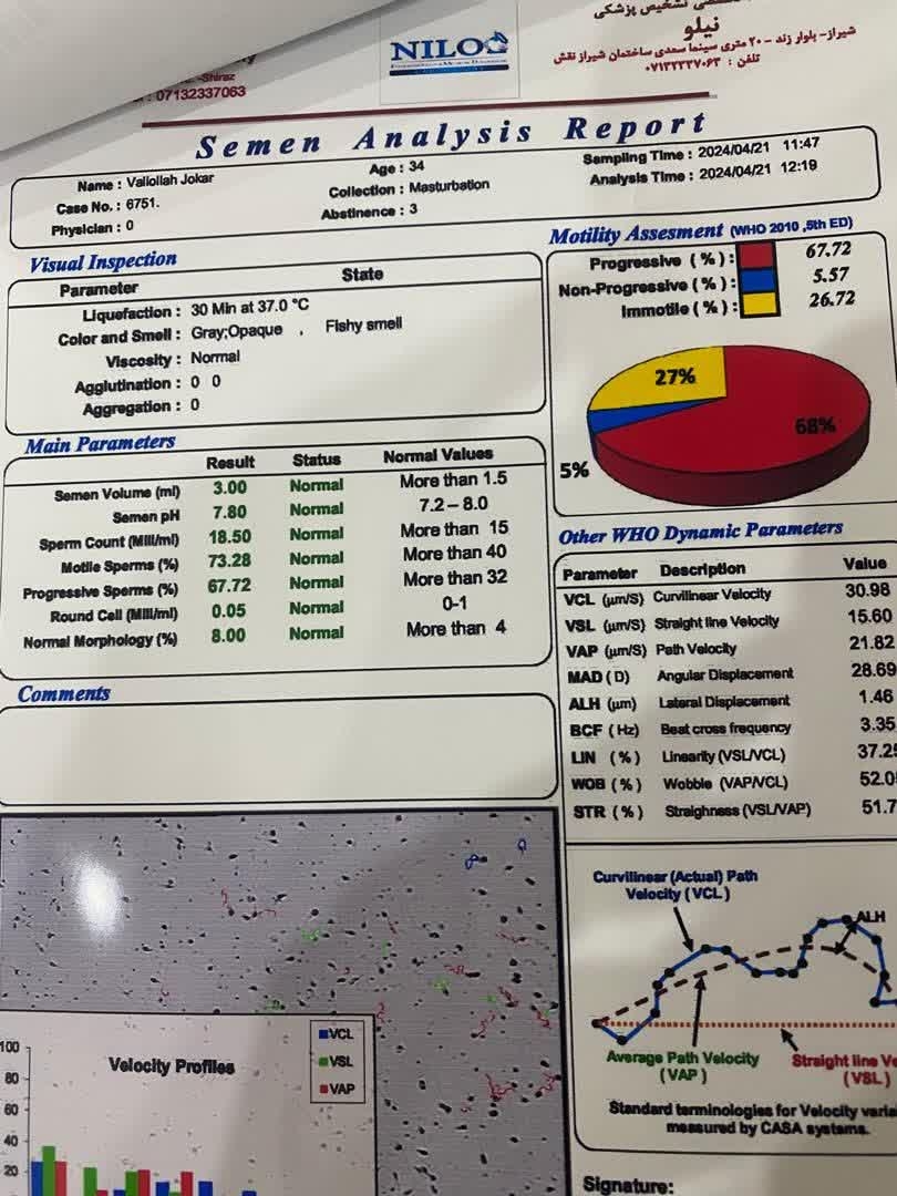 تفسیر ازمایش نمونه اسپرم