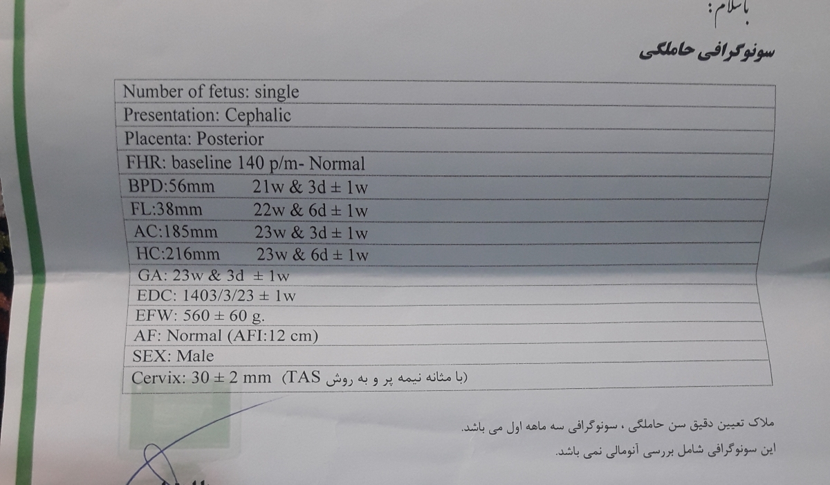 این سونوی قبلیه