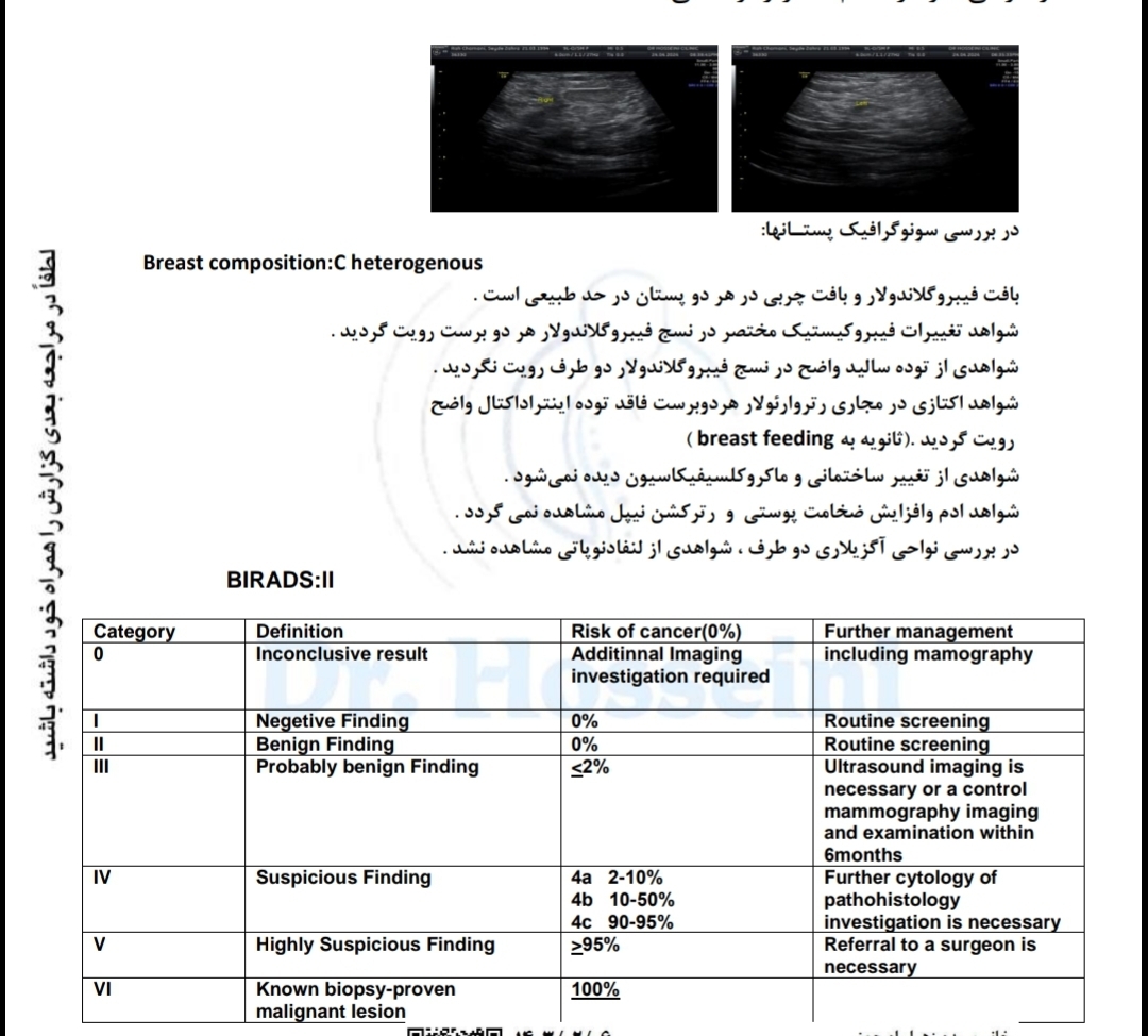 تفسیر سونو سینه