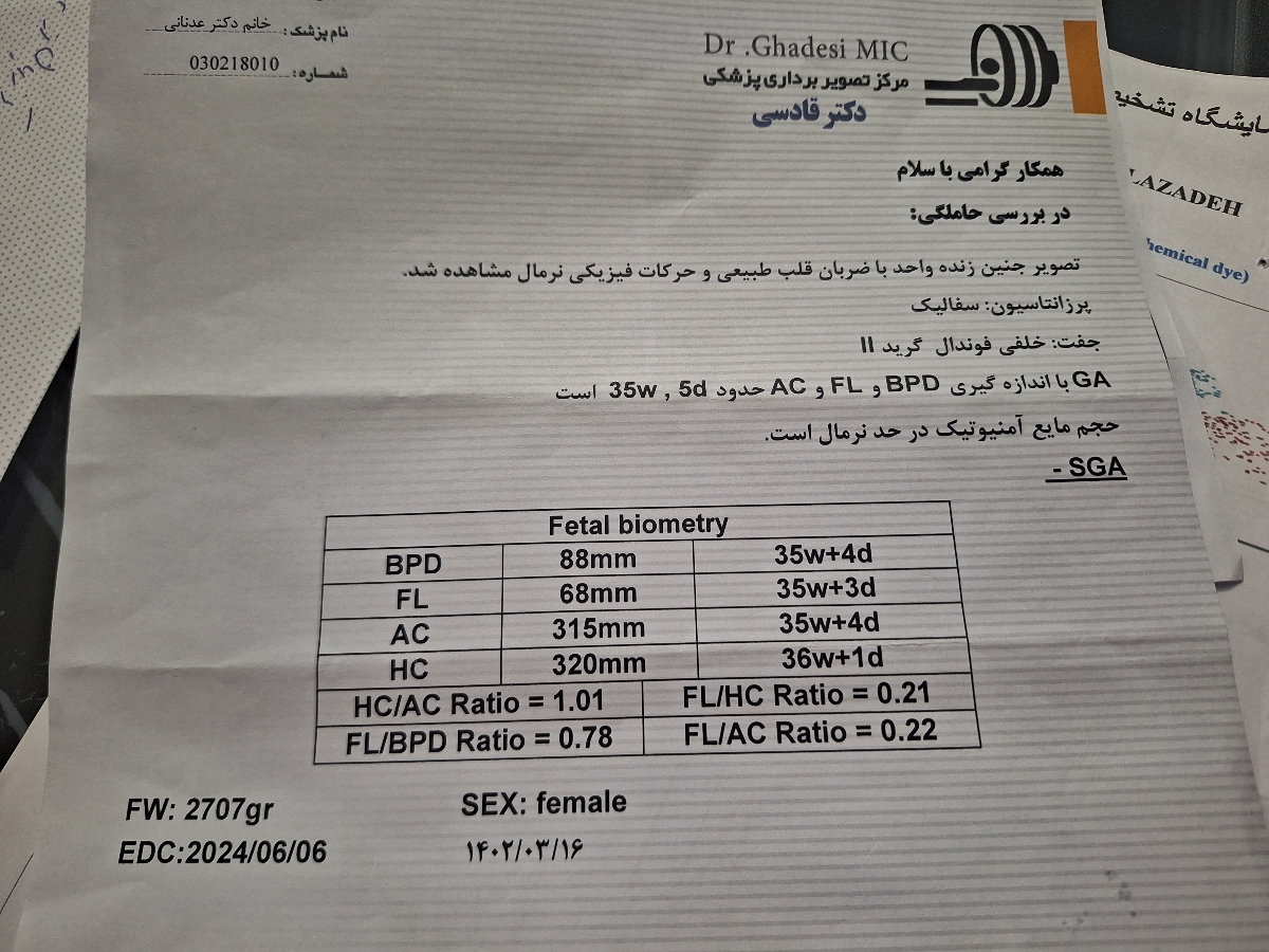 تزریق آمپول بتامتازون قبل از عمل سزارین