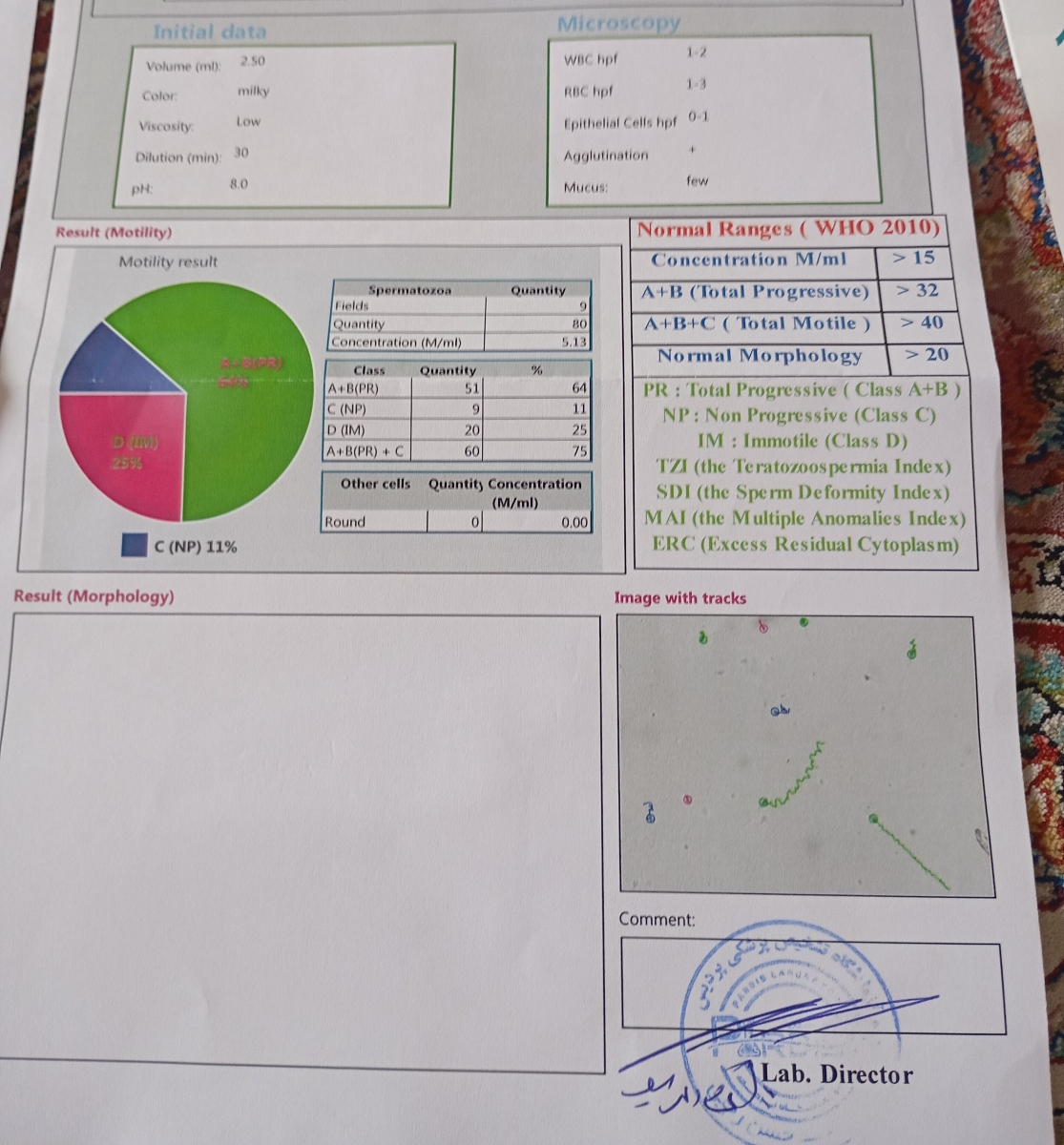 ازمایش سقط مکرر