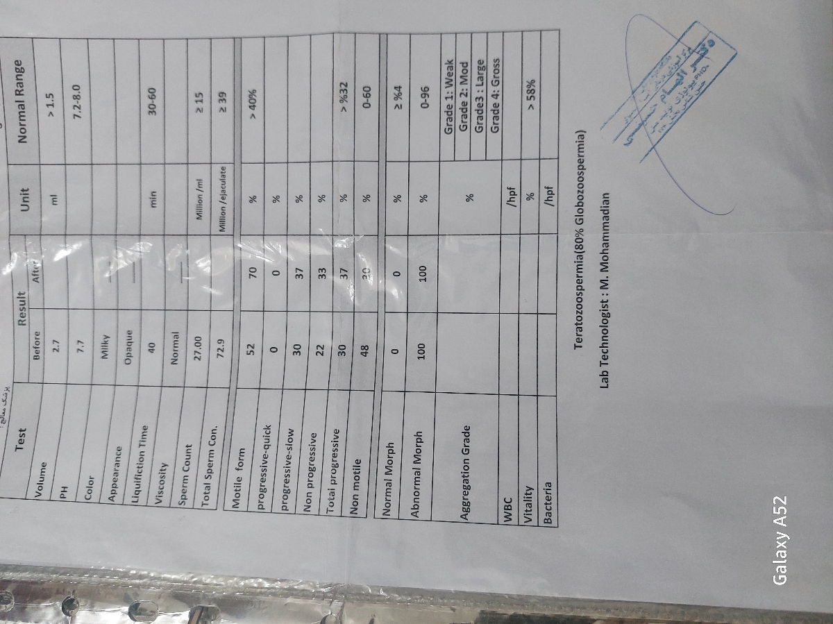 این  اولین ازمایش ک مرکز ناباروری انجام دادن قبل از مصرف دارو 