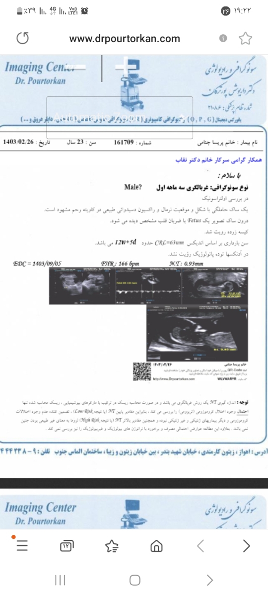 تفسیر سنوی ان تی تفسیر سنوی ان تی