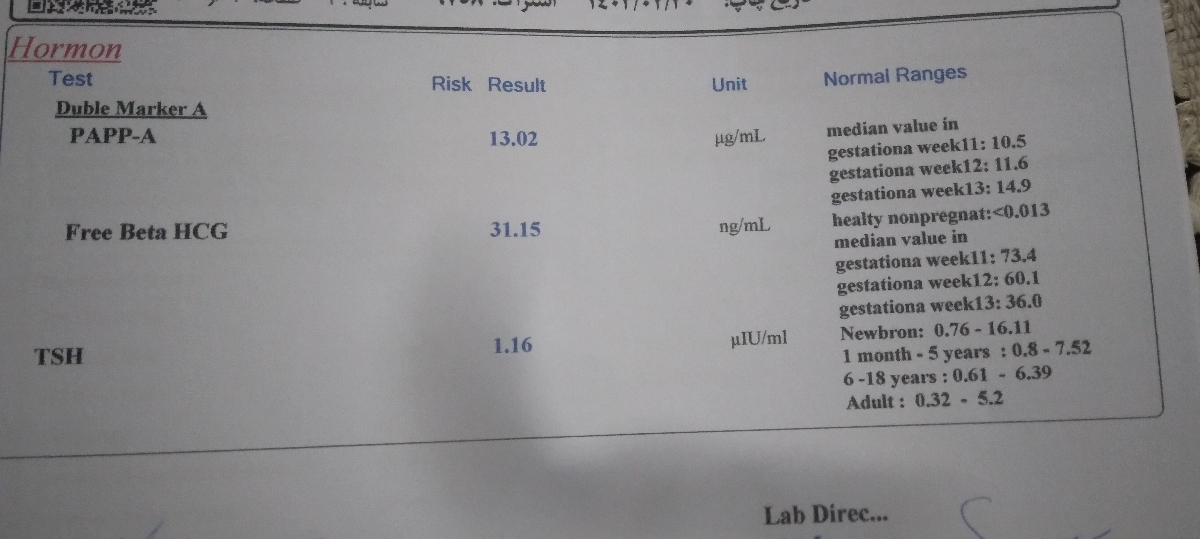 تفسیر آزمایش ان تی