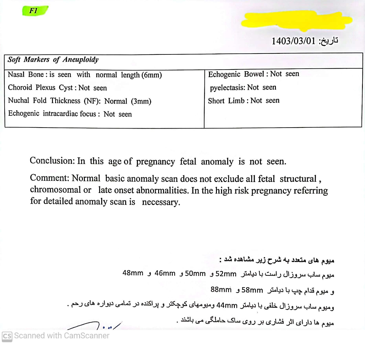 سونوگرافی آنومالی و فیبروم