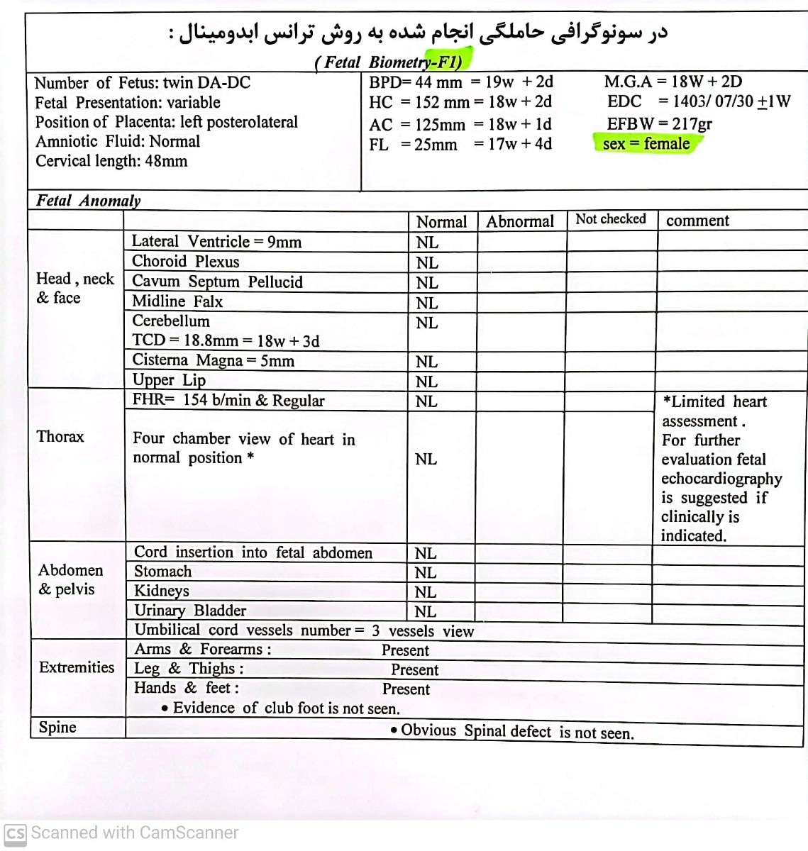 سونوگرافی آنومالی و فیبروم