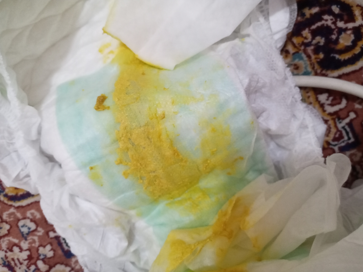 مدفوع خلطی نوزاد۳ ماهه