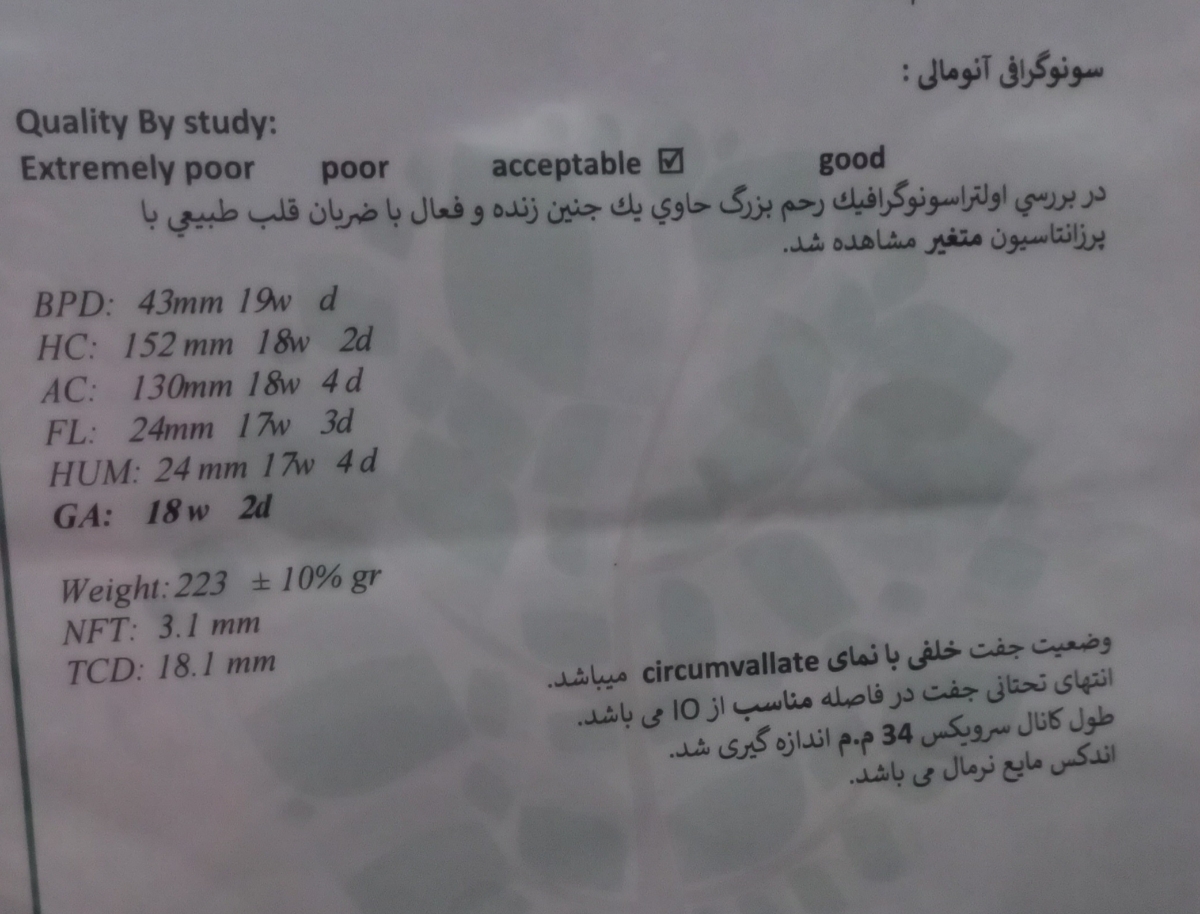 جفت خلفی سیرکومولیت در آنومالی