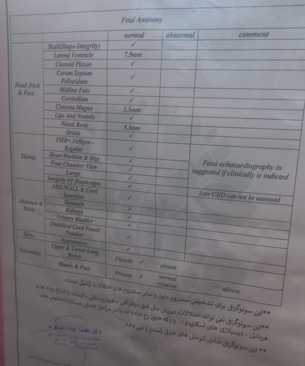 جفت خلفی سیرکومولیت در آنومالی