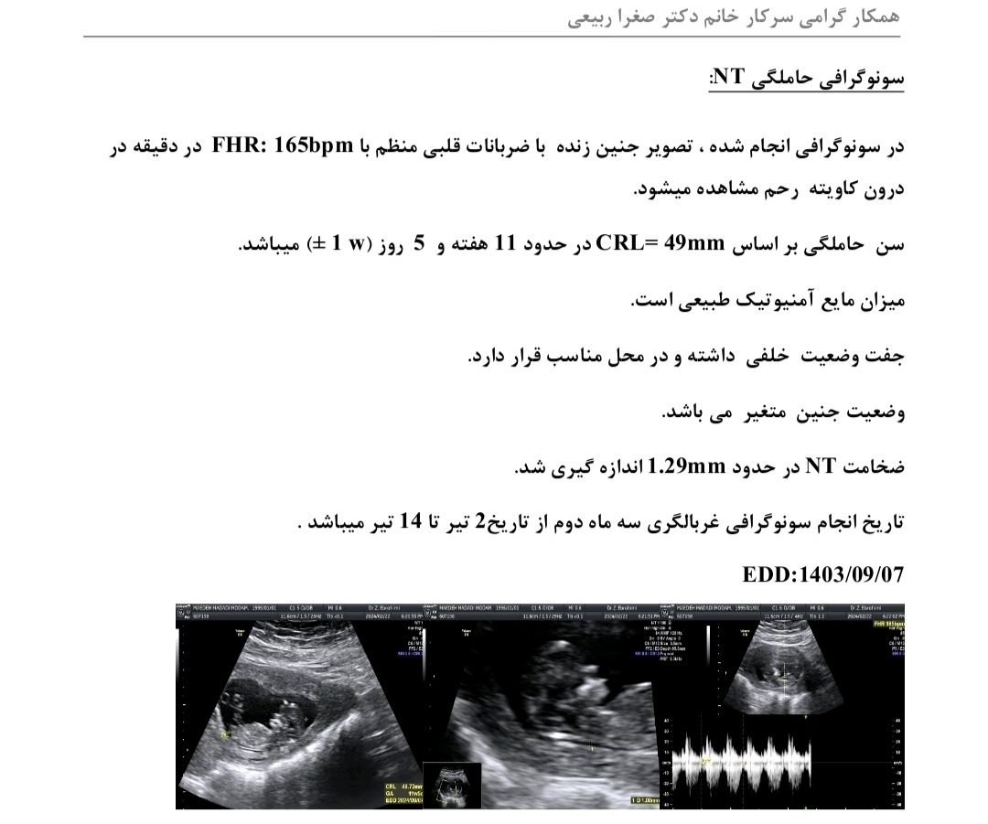 تعیین جنسیت با سونو ان تی تعیین جنسیت با سونو ان تی