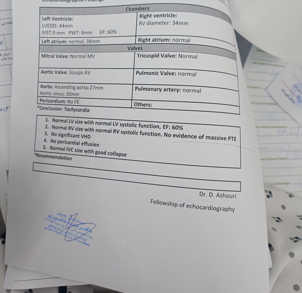 اسکن پرفیوژن هسته ای در بارداری