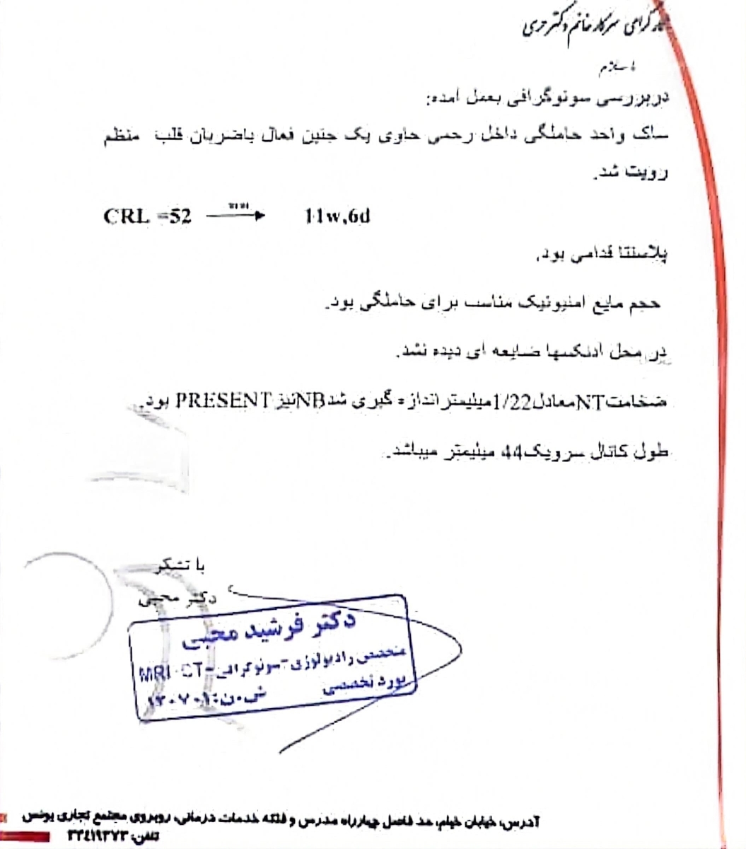 آزمایش غربالگری دوم بارداری