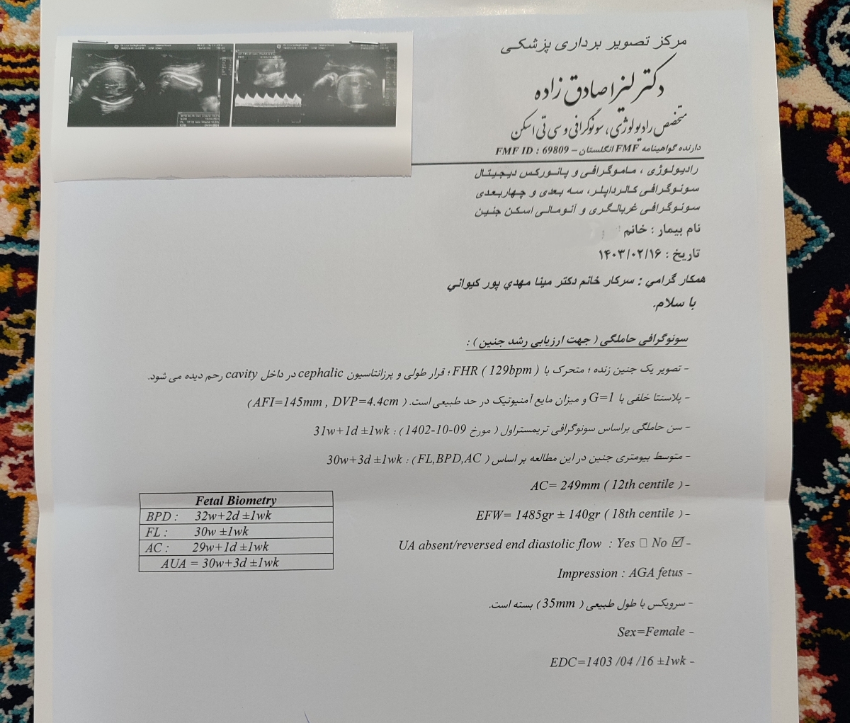 اینم سونو قبلیمه