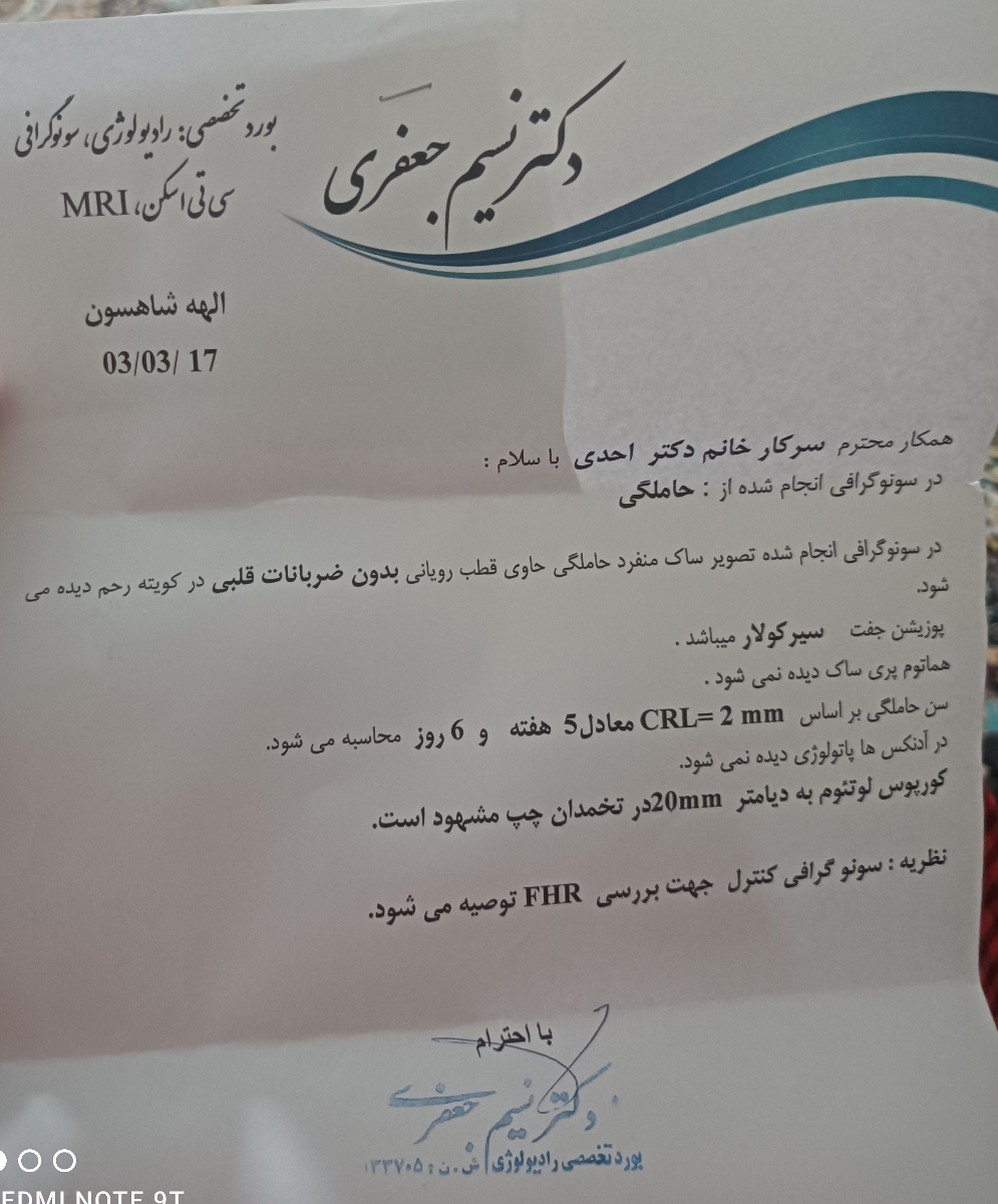 ایا این نوع جفت خطرناک است