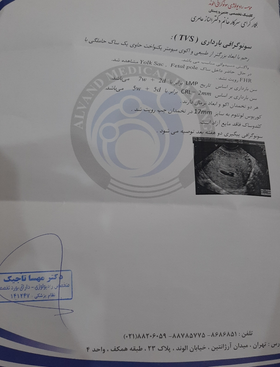 تفسیر سونوی بعد از بارداری تفسیر سونوی بعد از بارداری