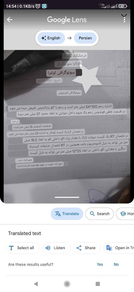 لطفا سونو داخلی تفسیر کنید❌️❌️❌️❌️❌️⭕️⭕️⭕️⭕️ لطفا سونو داخلی تفسیر کنید❌️❌️❌️❌️❌️⭕️⭕️⭕️⭕️