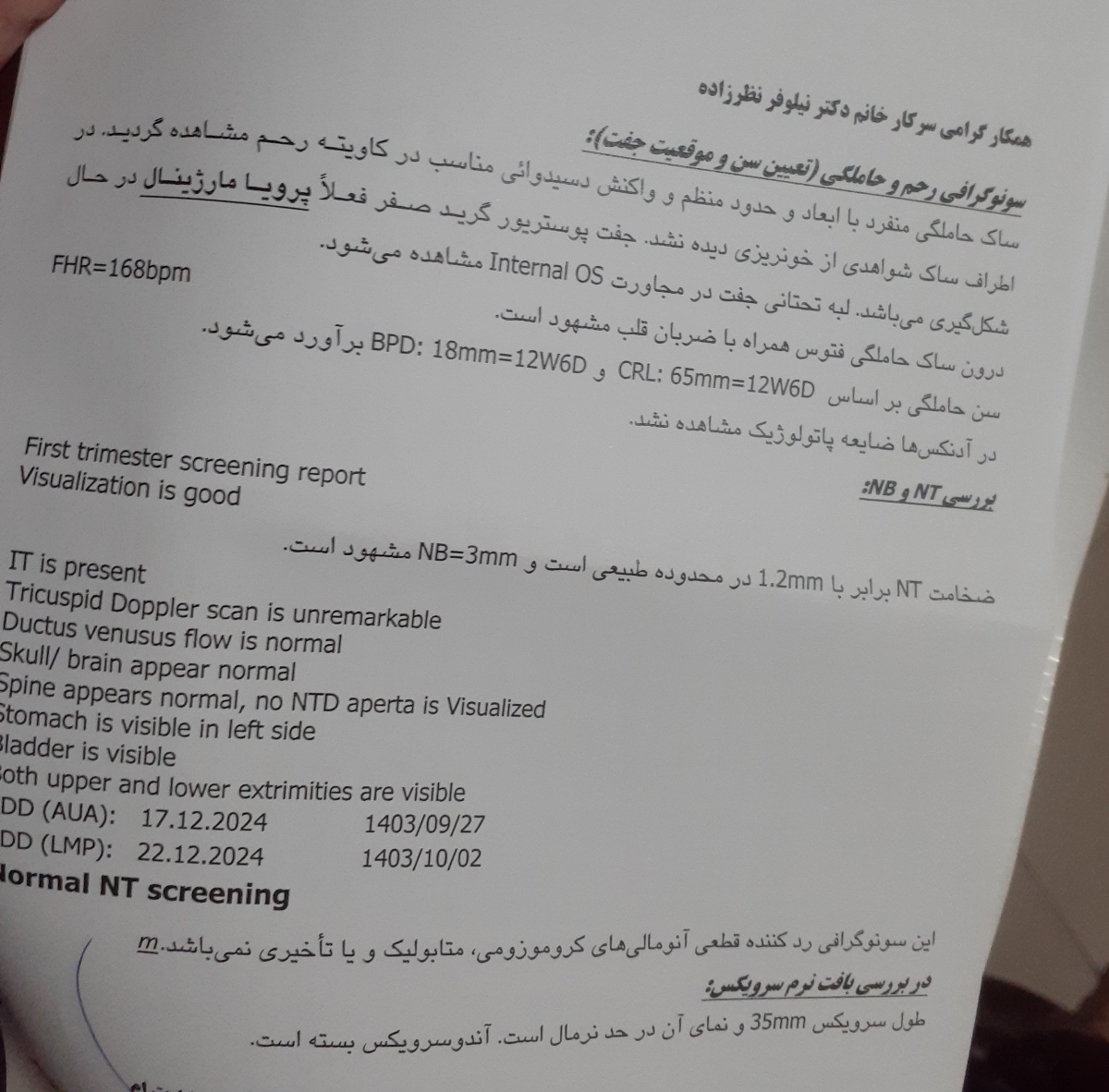 سنو گرافی ان تی