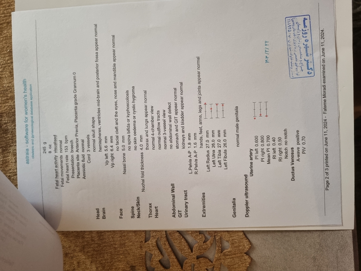 جواب سنو انومالی جواب سنو انومالی