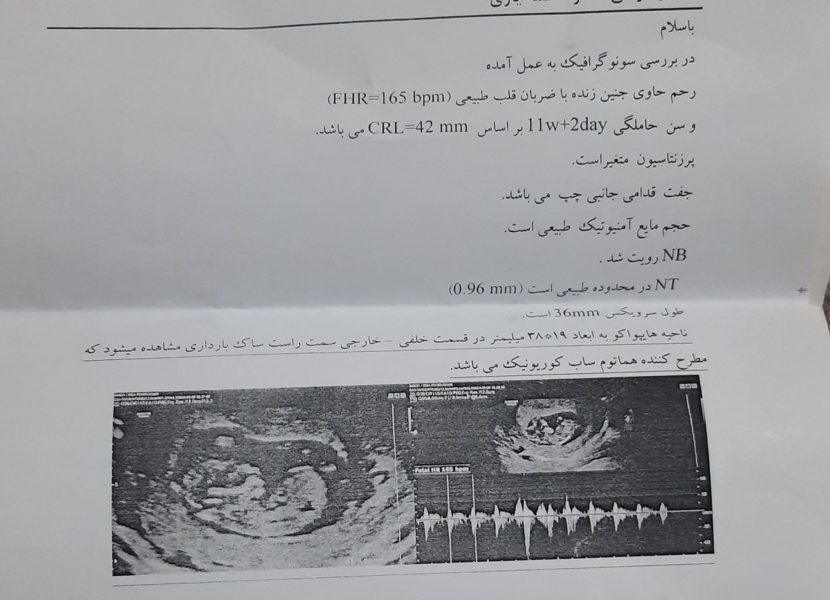 جواب آزمایش سلفری و نتیجه آن جواب آزمایش سلفری و نتیجه آن