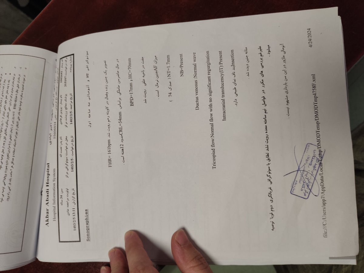 تفسیر اکوی قلب جنین تفسیر اکوی قلب جنین