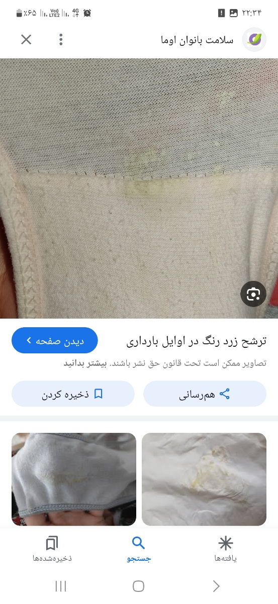 اگه از پماد استفاده نکنم ترشحاتم معمولا همینطوریه