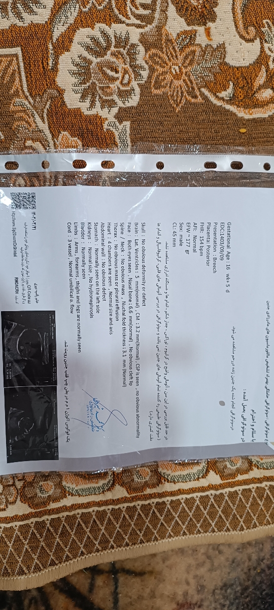 جواب سنو آنومالی. جواب سنو آنومالی.