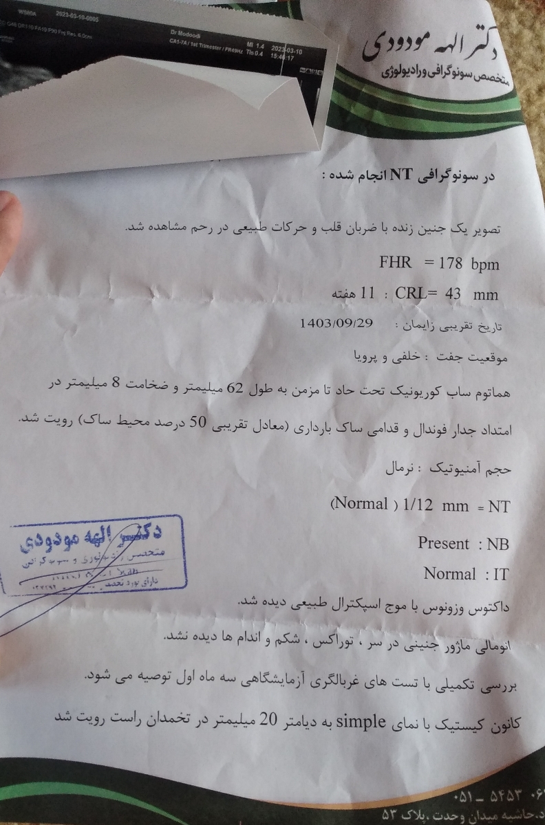 این سونو وقتی گرفتم خونریزی شدید داشتم 11 هفته این سونو وقتی گرفتم خونریزی شدید داشتم 11 هفته