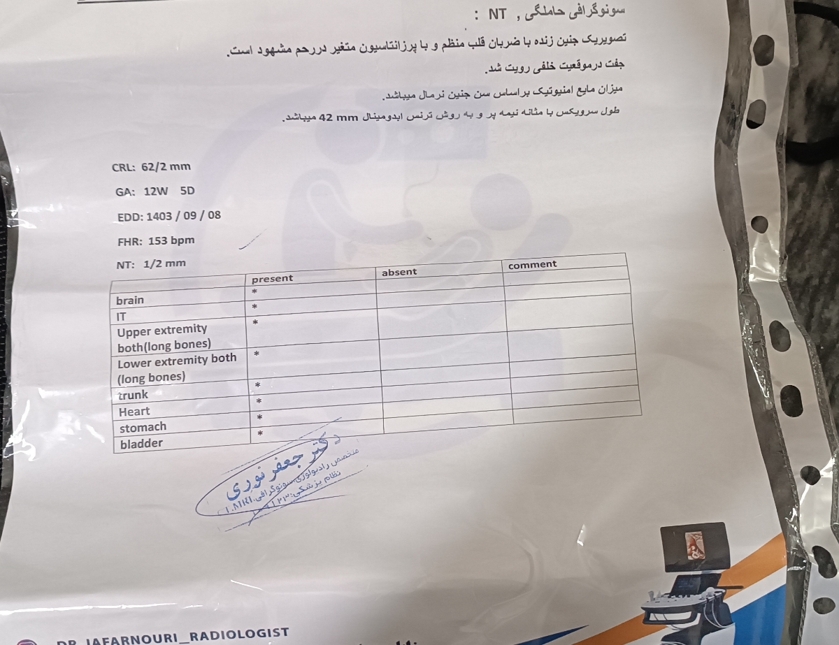 جواب سنو آنومالی. جواب سنو آنومالی.