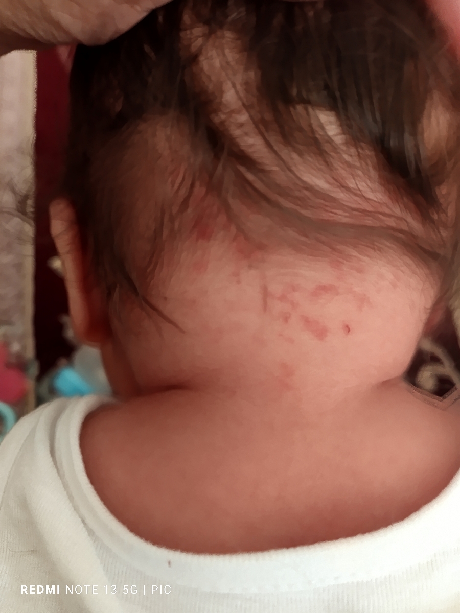 واکسن ۶ماهگی وعوارض ان واکسن ۶ماهگی وعوارض ان