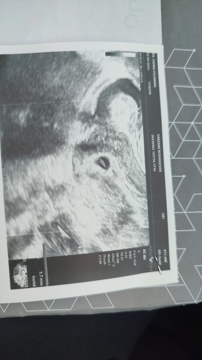 روند افزایش عدد بتا روند افزایش عدد بتا