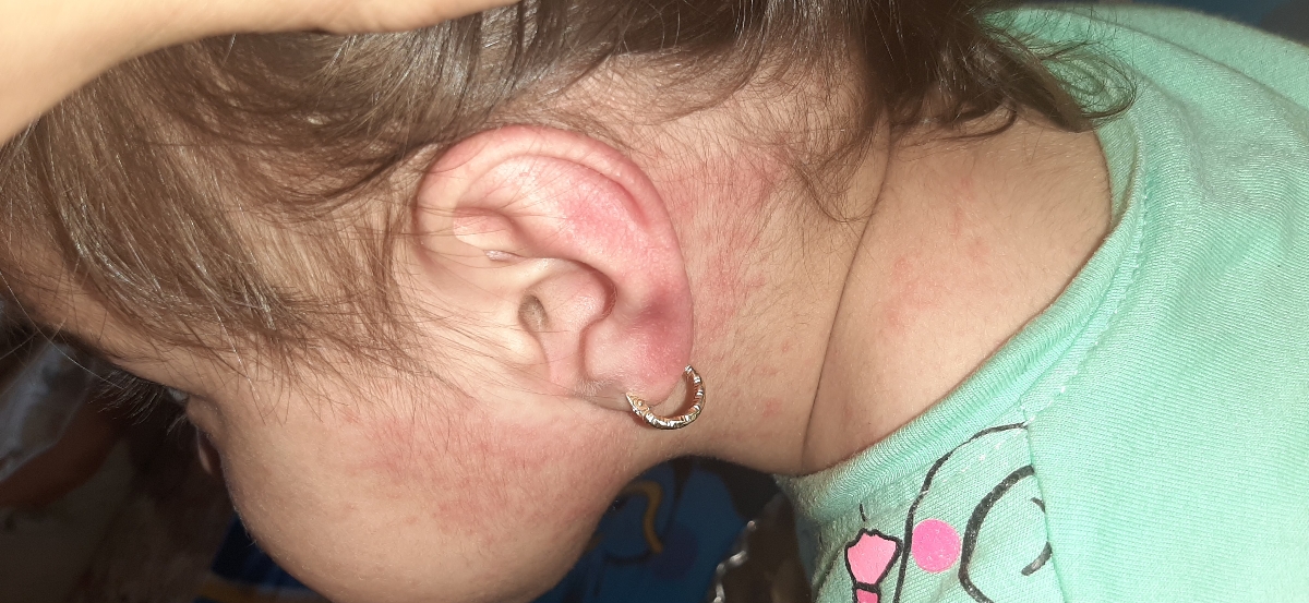 قرمزی صورت دهخترم قرمزی صورت دهخترم