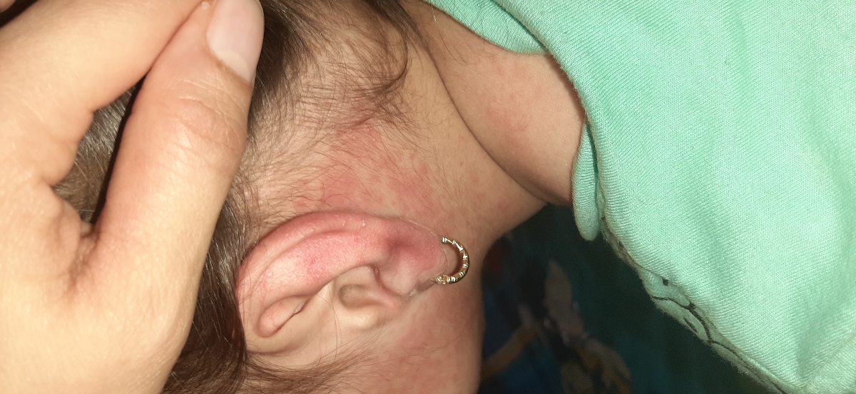 قرمزی صورت دهخترم قرمزی صورت دهخترم