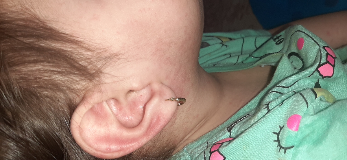 قرمزی صورت دهخترم قرمزی صورت دهخترم