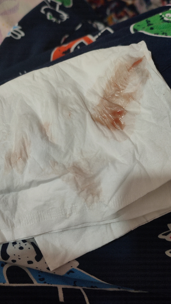 قرمز تر شده😭 قرمز تر شده😭