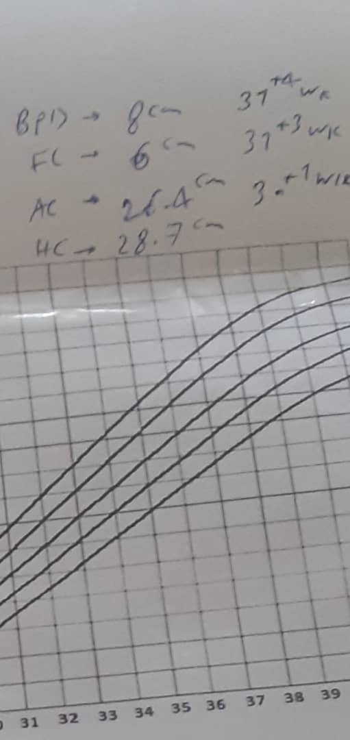 سونو در هفته ۳۱ بارداری