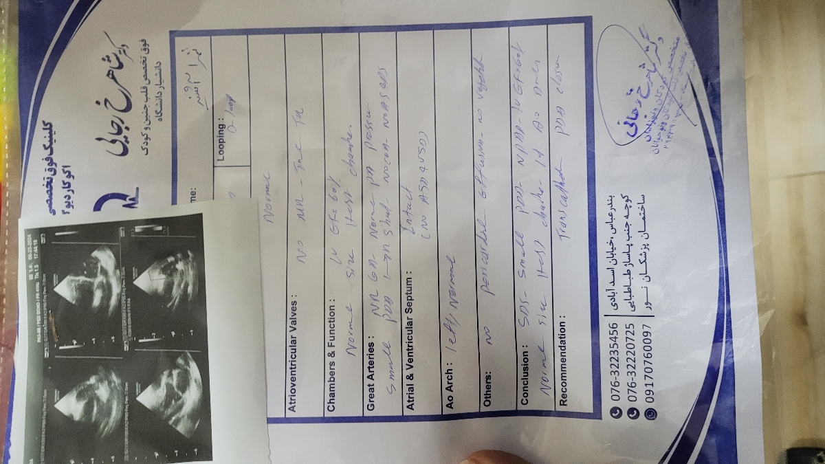 اکو قلب اکو قلب