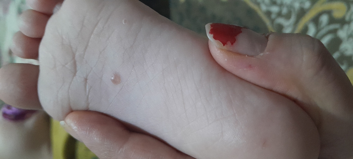 دونه زدن کف پایکم ابدارهستش