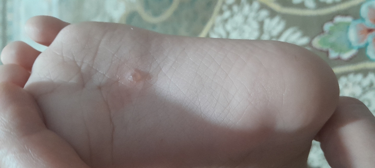 دونه زدن کف پایکم ابدارهستش