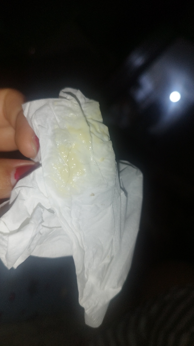 ترشح سبز در بارداری ترشح سبز در بارداری