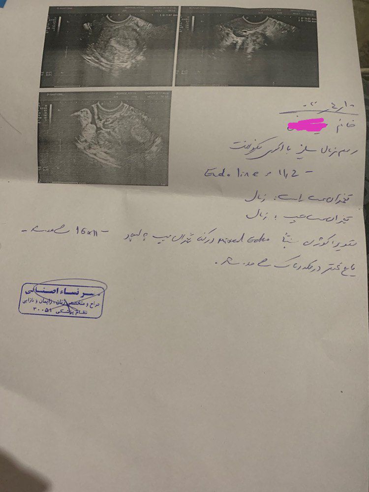 این سونو امروز هستش این سونو امروز هستش