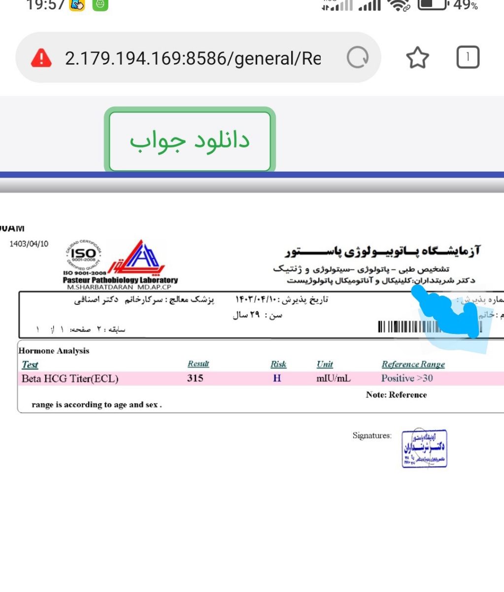 اینم آزمایش امروز این چهارمین آزمایش هست که تو طول هفته هر دو روز تکرار شده اینم آزمایش امروز این چهارمین آزمایش هست که تو طول هفته هر دو روز تکرار شده
