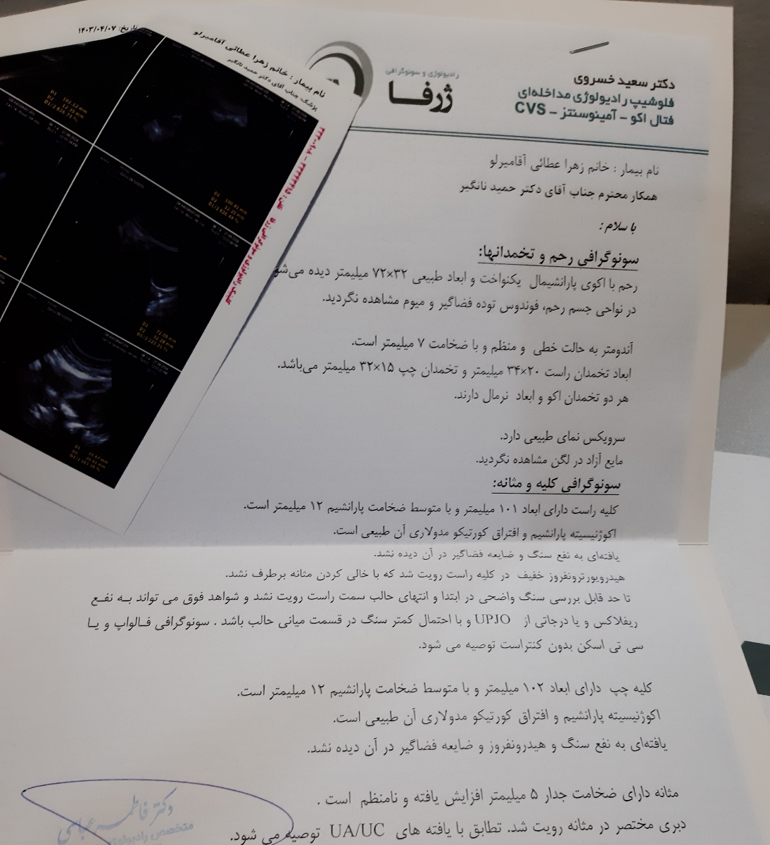 اقدام به بارداری