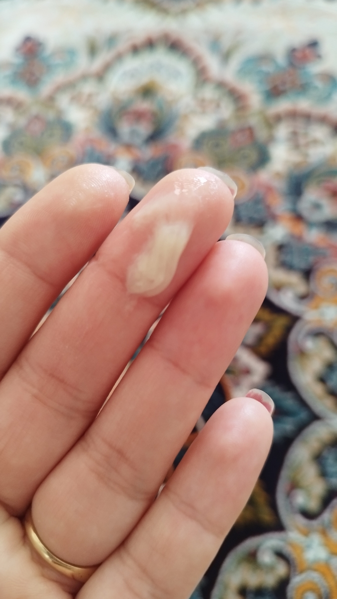 من الان ۴ شبه پماد استفاده میکنم ولی تغییری نکرده ترشحات
اینطور کشدار شده از حالت پنیری در اومده ولی خیلی کشدار شده من الان ۴ شبه پماد استفاده میکنم ولی تغییری نکرده ترشحات
اینطور کشدار شده از حالت پنیری در اومده ولی خیلی کشدار شده