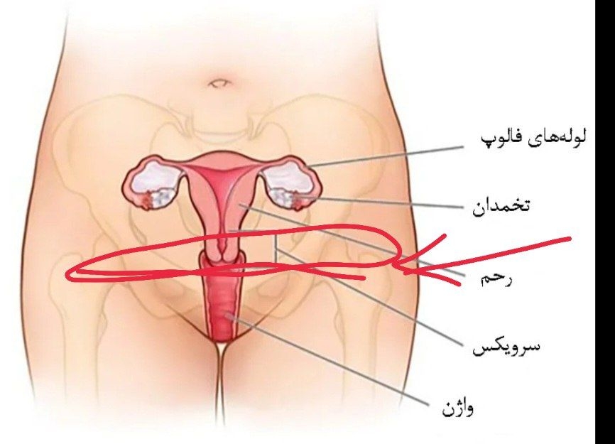 گاهی هم زیر شکمم درد میگیره حس سنگینی میکنم