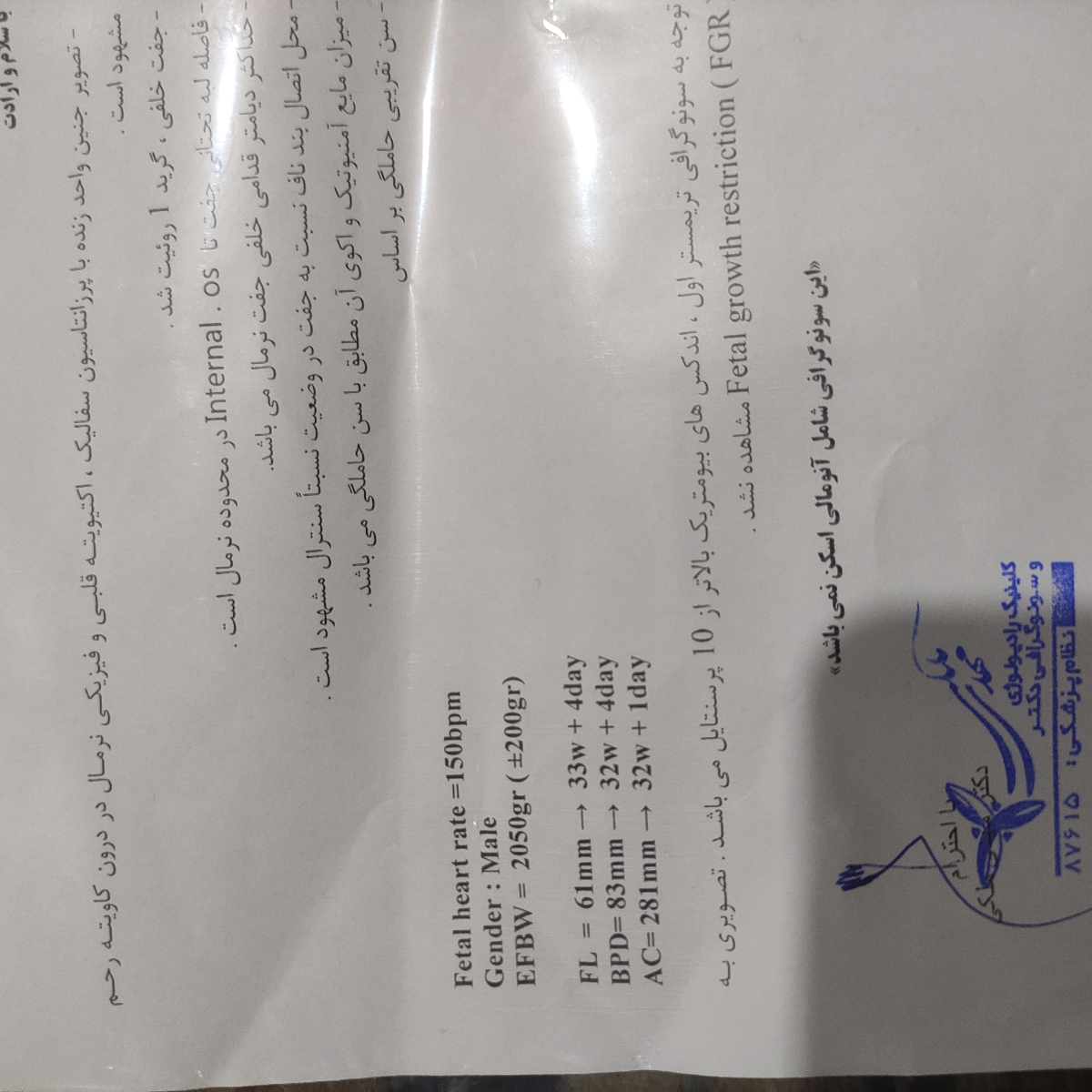 سونوگرافی آخر بارداری