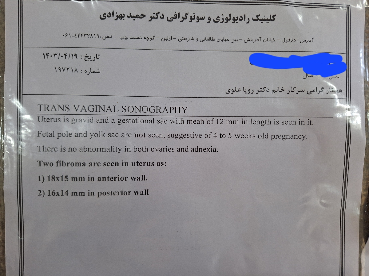 سونو ۱۹ تیر ماه